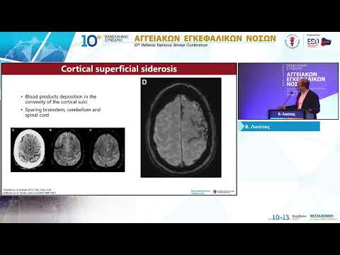 Λιούτας Β. - Νόσος μικρών αγγείων του εγκεφάλου: σύγχρονη διαγνωστική και θεραπευτική προσέγγιση
