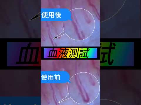 微血循環檢測