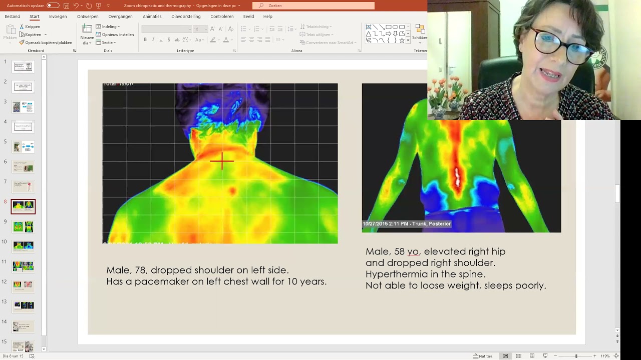 Chiropracty and Medical Thermography | De Groene Zuster