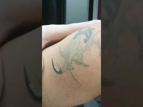 Videos from Unwanted Tattoos