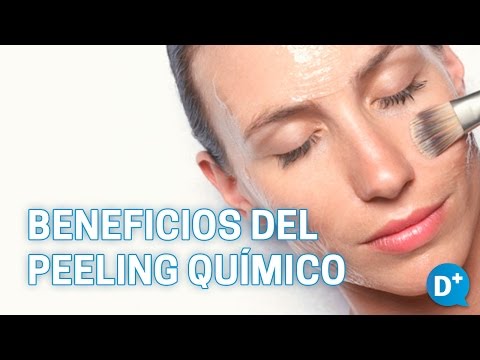 Beneficios del peeling químico