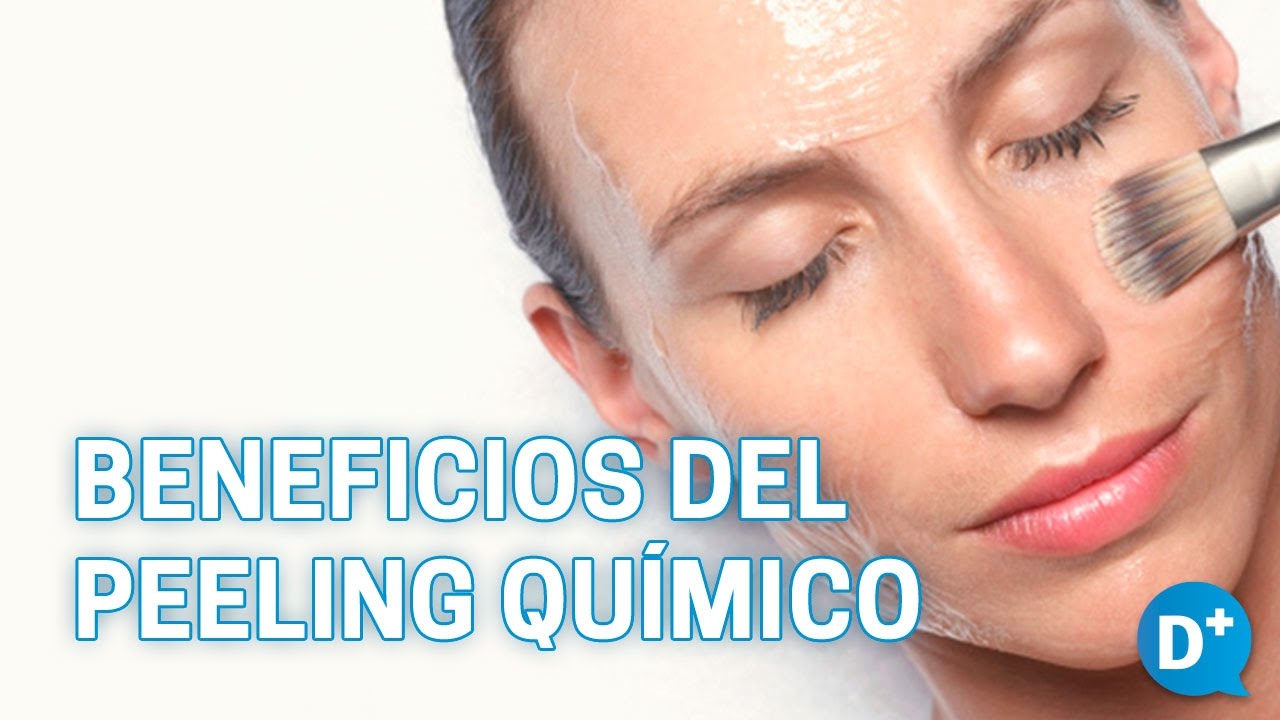 Beneficios del peeling químico