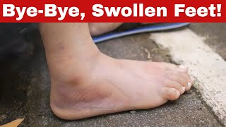 How to Get Rid of Swollen Feet Fast and Easy with Proven Methods!