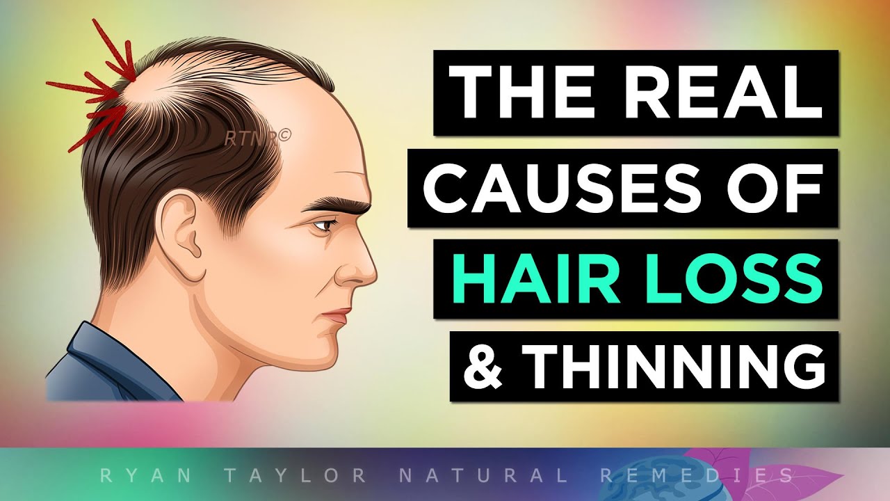 The REAL Causes of HAIR LOSS