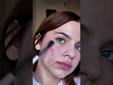MAQUIAGEM QUE NÃO ESCONDE ACNE #ToBemNoShorts #Publi