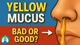 Does Yellow Mucus Mean You're Getting Better?