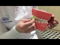 Čistenie Zubov S Dental Brothers
