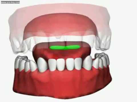 #how to #pronounce the #letter #"zaal"