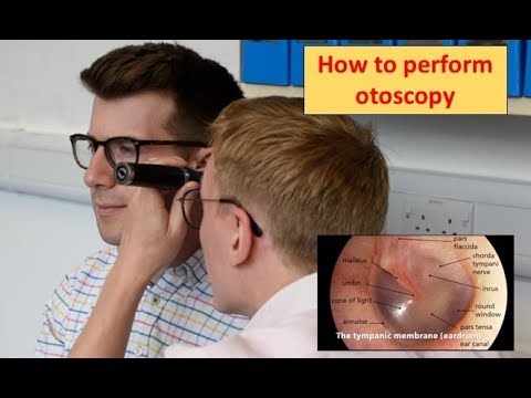 How to perform Otoscopy (Ear Exam)