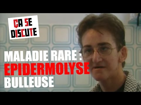 Maladie rare : vivre avec l'épidermolyse bulleuse - Ça se discute