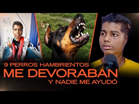 This is how I survived an attack by 9 hungry stray dogs: 150 bites, and I lost my arms and ears