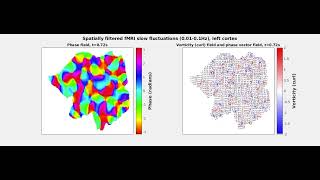 Newswise:Video Embedded brain-activity-organized-by-spiral-signals-found