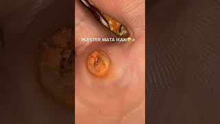 Download lagu PLESTER MATA IKAN || @imyourkeya mp3 Download lagu PLESTER MATA IKAN || @imyourkeya mp3