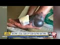 Ohio Man Contracts Flesh Eating Bacteria In Tampa Bay