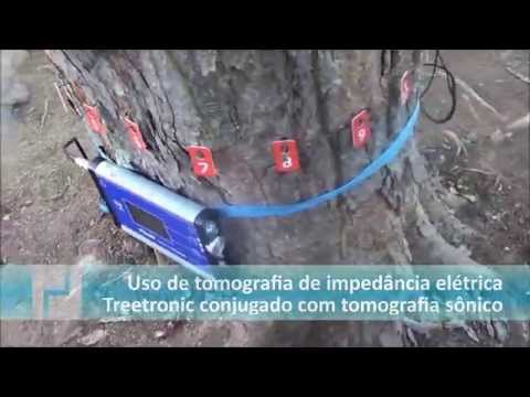 Tomógrafo por impedância elétrica