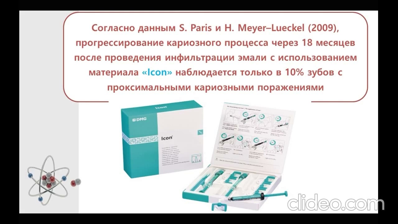 Методы лечения острого и хронического глубокого кариеса