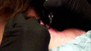 Me getting my All Time Low tattoo