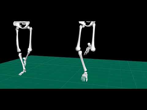 Douglas Bader Gait Laboratory presents: Riverdance