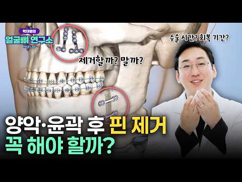 양악·윤곽수술 후 핀제거 꼭 해야 할까? | 핀제거 타이밍, 통증, 타원 제거, 회복기간
