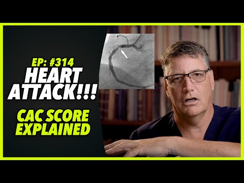 Ep:314 HEART ATTACK!!!! – CAC SCORE EXPLAINED