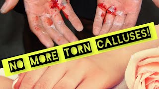 Protect Your Hands: 5 Essential Kettlebell Training Tips to Prevent Tears!