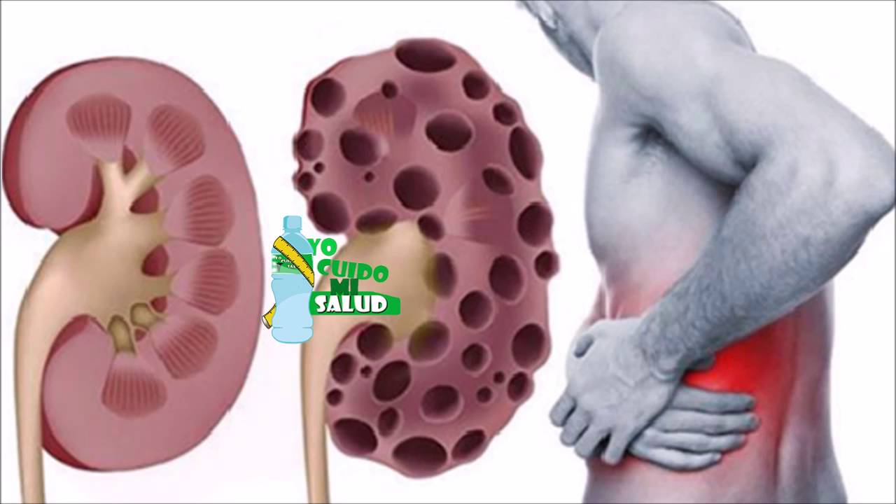 Israel Eliut Ramos Naranjo-4