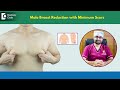 Huge Male Boobs Or Severe Gynecomastia Treatment With LESS SCAR Dr Aniketh Venkataram Doctors Circle