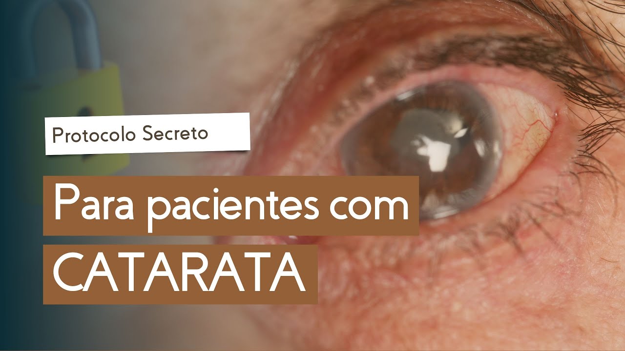 Como ter uma BOA RECUPERAÇÃO após a cirurgia de CATARATA? | Emmerson Badaró