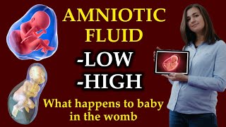 What happens to baby in womb when amniotic fluid is low or high | Polyhydramnios and Oligohydramnios