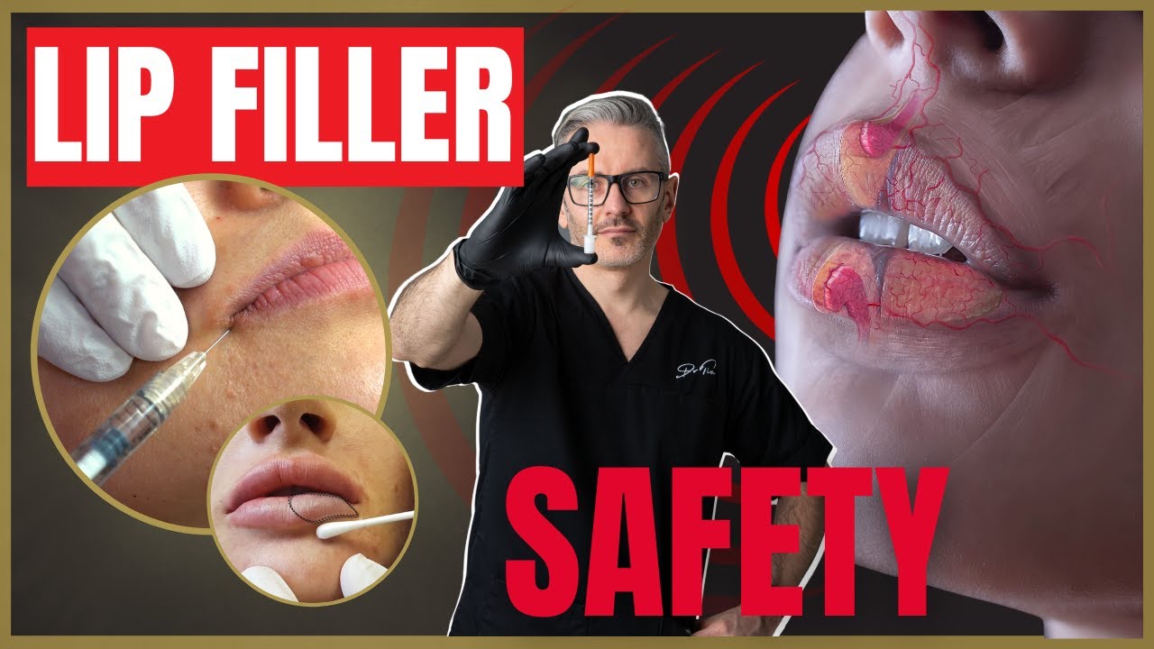 6 Lip Filler Safety Tips | How to avoid Lip Filler side effects and complications