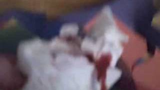 safety pin through my hand