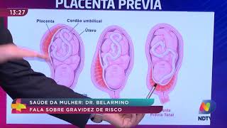 Entenda o que é gravidez de alto risco - Dr. Belarmino