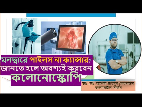 কলোনোস্কোপি কেন করবেন? এটা কি ক্যান্সার প্রতিরোধ করতে পারে?