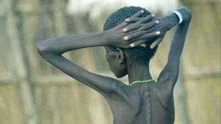 Cuestión de prioridades por el Cuerno de África.(Melendi, Dani Martín, Malú, Pablo Alborán..)