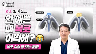 [무.물] 복코 수술, 잘하는 법이 따로 있다고?! ｜1%성형외과  #김종구 #코수술 #코재수술