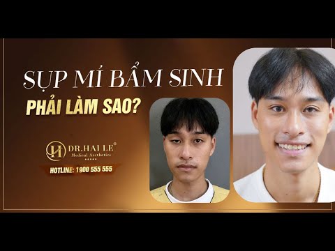 Dr.Hải Lê giải cứu mọi ca mí sụp bẩm sinh giúp khách hàng tự tin thêm một lần nữa