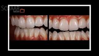 Fotoslideshow Dentalfotografie