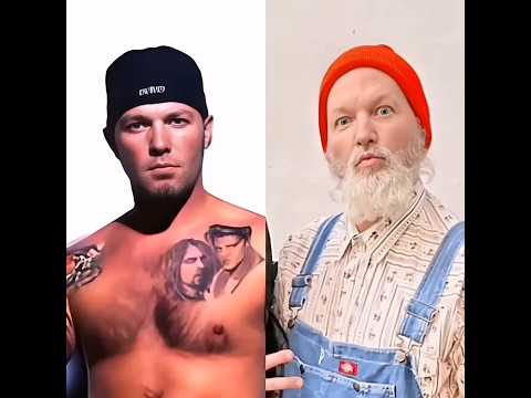 limp bizkit#then and now#short