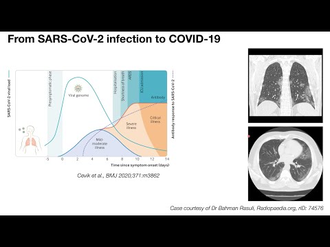 SCOG Virtual Lecture Series - Emanuel Wyler (BIMSB/MDC, Berlin)