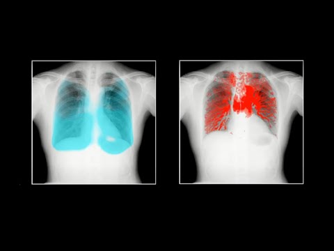 【ココカラ】Research56「肺機能を，動画で見える化！」/医薬保健研究域附属AIホスピタル・マクロシグナルダイナミクス研究開発センター 田中利恵准教授/金沢大学研究紹介動画