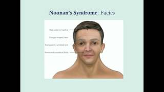 Download lagu Noonan's Syndrome - CRASH! Medical Review Series mp3