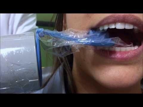 Radiografia Periapical com Posicionadores - Mandíbula Posterior
