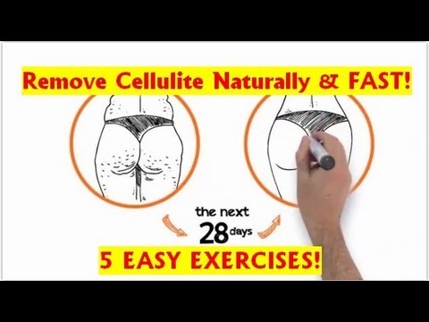 Pagsasanay para sa mga binti slimming sa bahay mabilis Ang lahat ng mga pagbaba ng timbang pamamaraan na may golden needle