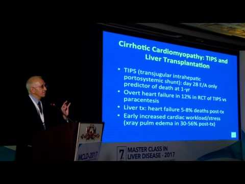 MCLD  2017 Cirrhotic Cardiomyopathy Patrick Kamath.mpeg