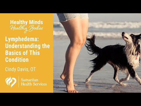 Lymphedema: Understanding the Basics of This Condition