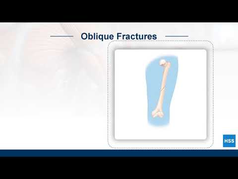 The Human Body: Fractures