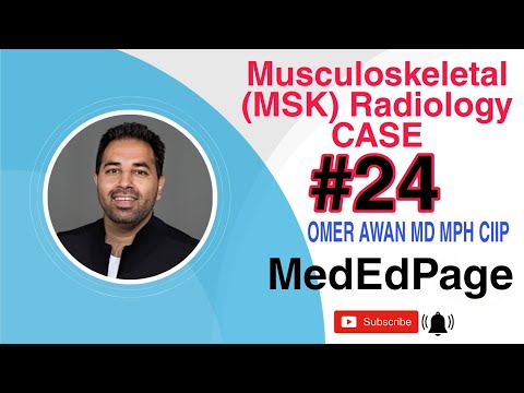 Musculoskeletal (MSK) Radiology CASE #24