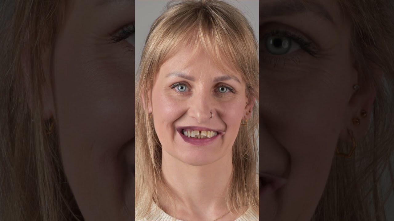 Jak uśmiech zmienia życie