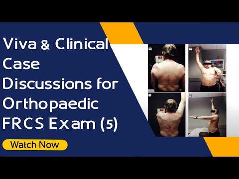 Viva & Clinical Case Discussions for Orthopaedic FRCS Exam (5)