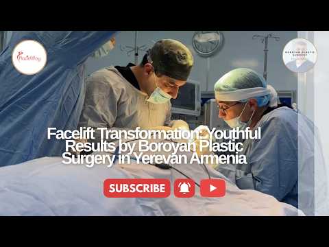 Facelift Transformation: Youthful Results by Boroyan Plastic Surgery in Yerevan Armenia